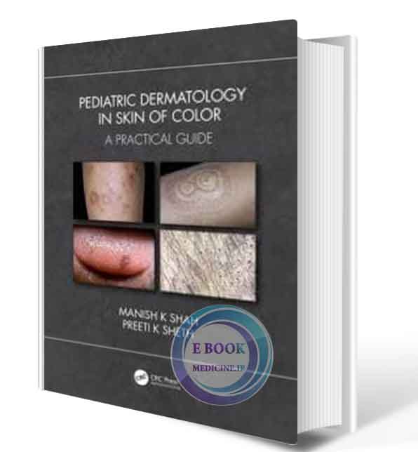 دانلود کتاب Pediatric Dermatology in Skin of Color: A Practical Guide  2021 (ORIGINAL PDF) 